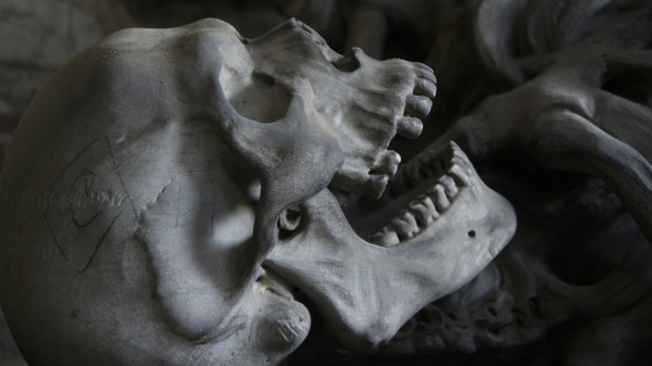 В НИИ Джанелидзе начали применять 3D-печать для восстановления черепных дефектов