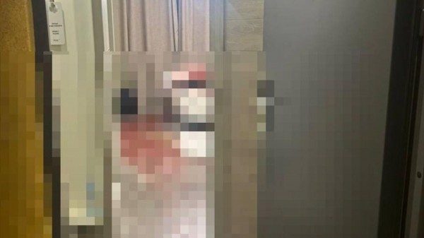 Подозреваемый в убийстве 15-летней в отеле в Петербурге был в состоянии психоза Подозреваемый в убийстве 15-летней в отеле в Петербурге был в состоянии психоза